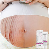 Pregnancy Scar Remover