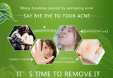 Acne Treatment